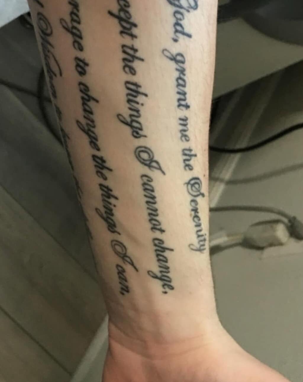 Tattoo before laser removal treatment